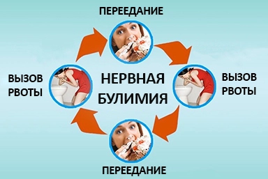 Лечение булимии в Рощинском